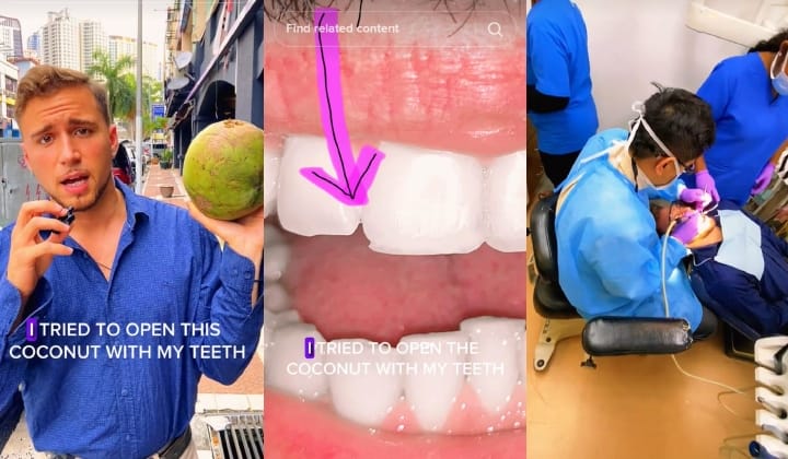 [Video] Mat Saleh Terpaksa Rawat Semula Gigi Di Klinik Lepas Cubaan Buka Buah Kelapa Guna Gigi